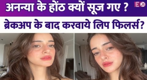 ब्रेकअप के बाद Ananya Pandey ने बदला चेहरा, करवाए Lip Fillers? लोगों के लिये पहचानना हुआ मुश्किल !