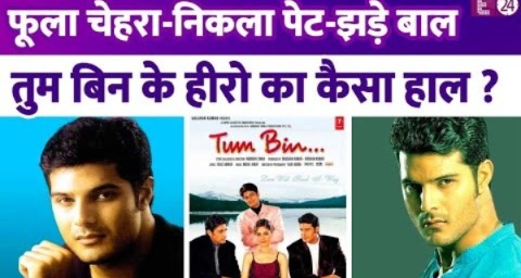 Tum Bin फेम Himanshu Malik के झड़ गए बाल, सूजा चेहरा…निकली तोंद.. पहचानना हुआ मुश्किल