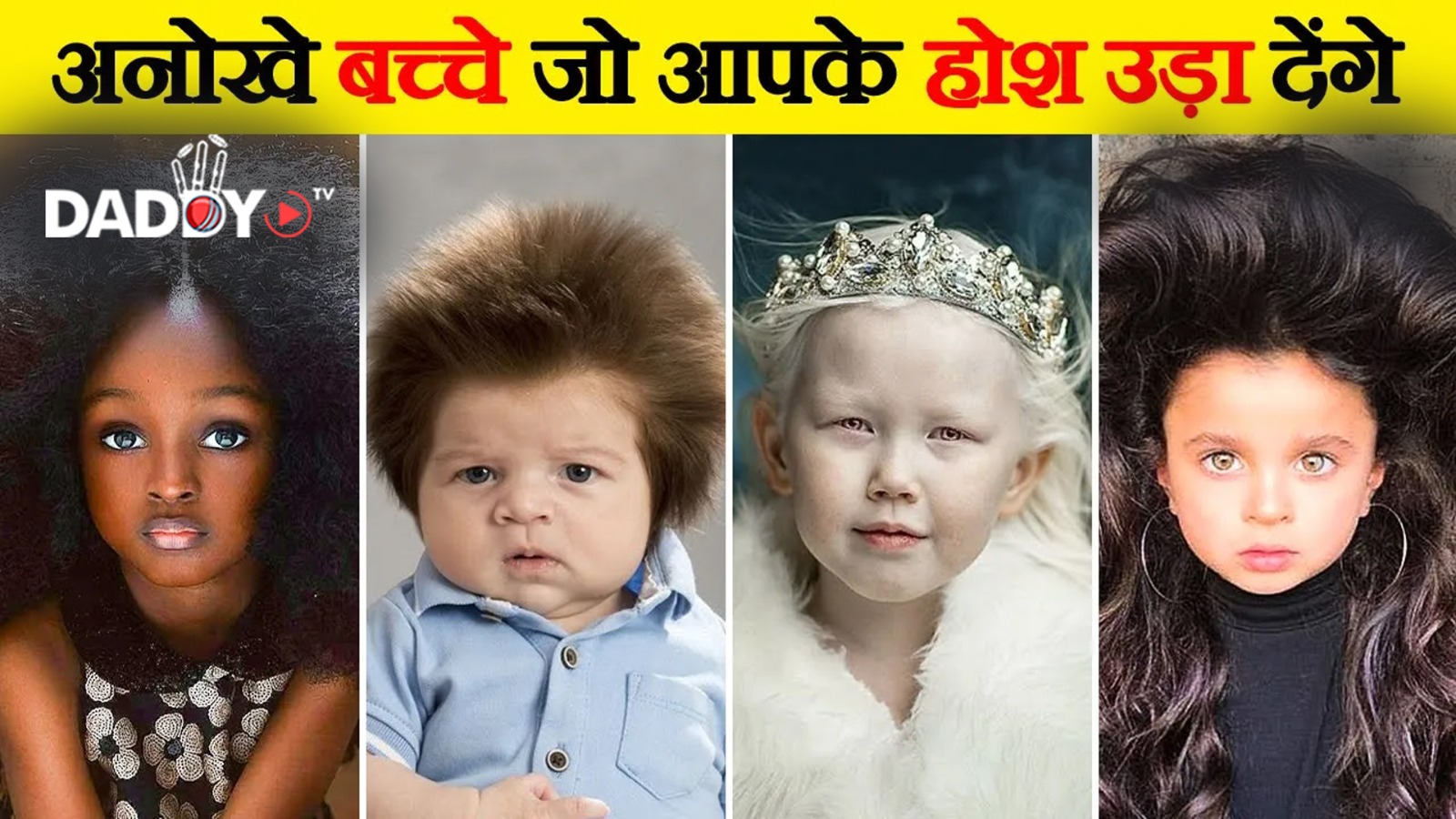 लाखो में एक है ये अनोखे बच्चे | 10 Most UNUSUAL Kids In The World | Kids You Won’t Believe Exist