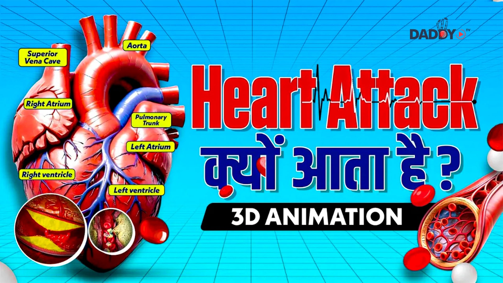 Why HEART ATTACKS Happen?